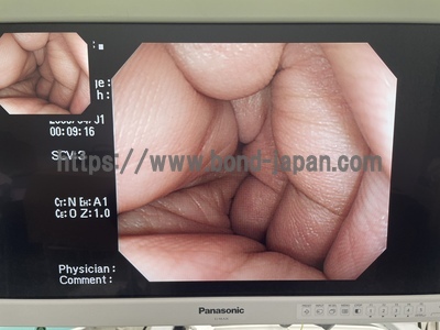 Video Colonoscope&nbsp;|&nbsp;OLYMPUS&nbsp;|&nbsp;CF-H260AZI