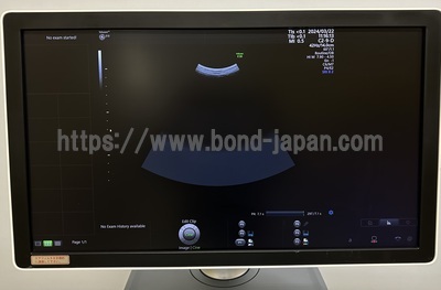 4D Ultrasound&nbsp;|&nbsp;GE&nbsp;|&nbsp;Voluson E10 BT19