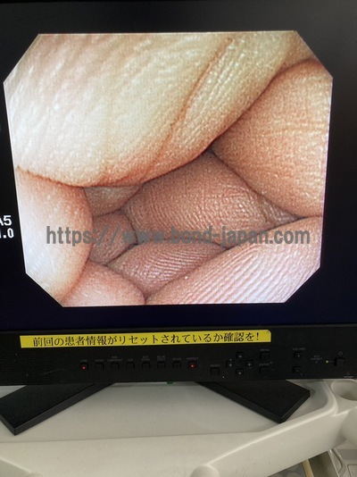 Video Colonoscope&nbsp;|&nbsp;OLYMPUS&nbsp;|&nbsp;PCF-Q260AZI