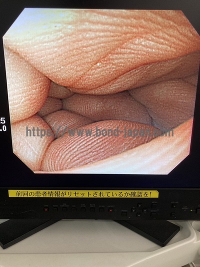 Video Gastroscope&nbsp;|&nbsp;OLYMPUS&nbsp;|&nbsp;GIF-Q260