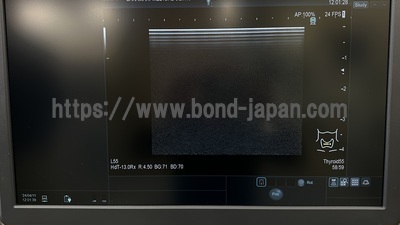 超音波診断装置&nbsp;|&nbsp;日立製作所&nbsp;|&nbsp;Arietta 65の写真