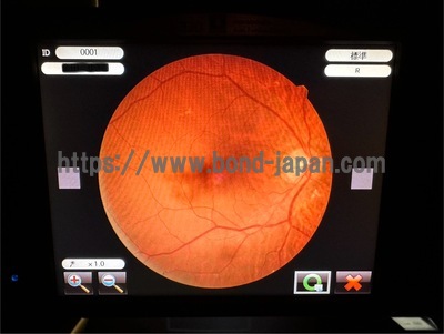 Fundus Camera&nbsp;|&nbsp;NIDEK&nbsp;|&nbsp;AFC-330
