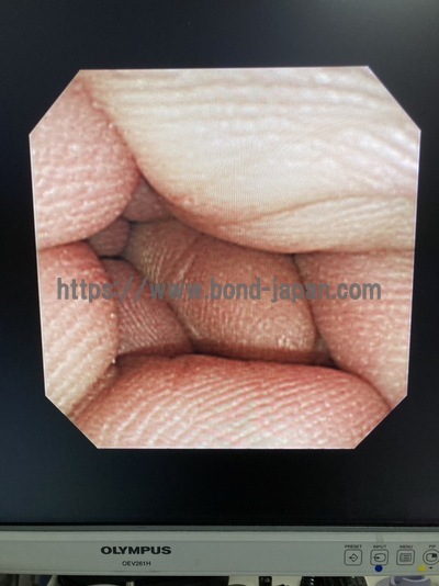 Video Gastroscope&nbsp;|&nbsp;OLYMPUS&nbsp;|&nbsp;GIF-XP260N