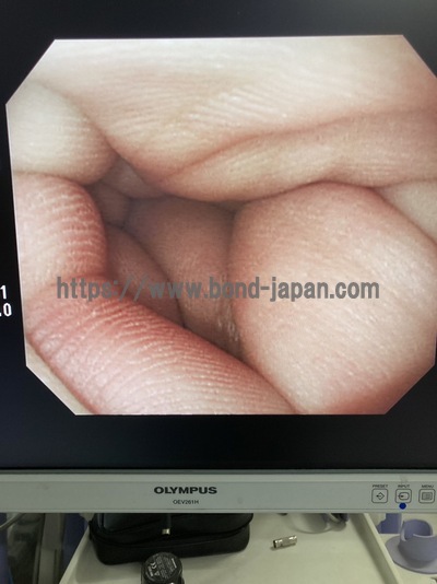 Video Gastroscope&nbsp;|&nbsp;OLYMPUS&nbsp;|&nbsp;GIF-Q260