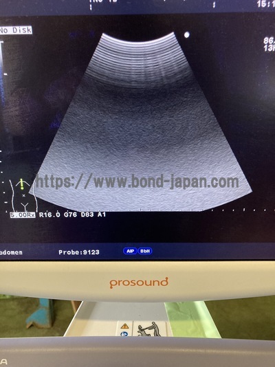 Color Doppler&nbsp;|&nbsp;HITACHI&nbsp;|&nbsp;Prosound α6