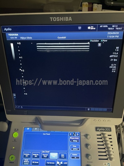 Color Doppler&nbsp;|&nbsp;CANON&nbsp;|&nbsp;Aplio 300