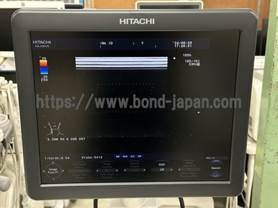 Color Doppler&nbsp;|&nbsp;HITACHI&nbsp;|&nbsp;F37