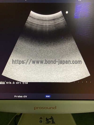 Color Doppler&nbsp;|&nbsp;HITACHI&nbsp;|&nbsp;Prosound α6