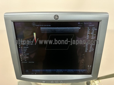 Color Doppler&nbsp;|&nbsp;GE&nbsp;|&nbsp;LOGIQ P5