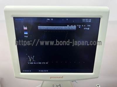Color Doppler&nbsp;|&nbsp;HITACHI&nbsp;|&nbsp;Prosound α6