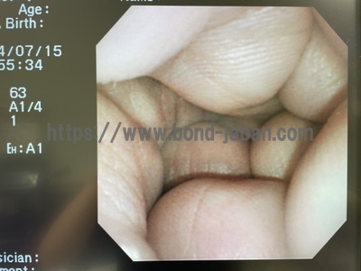 Video Gastroscope&nbsp;|&nbsp;OLYMPUS&nbsp;|&nbsp;GIF-XP260N