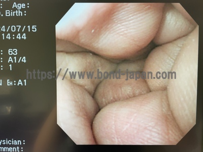 Video Gastroscope&nbsp;|&nbsp;OLYMPUS&nbsp;|&nbsp;GIF-XQ230