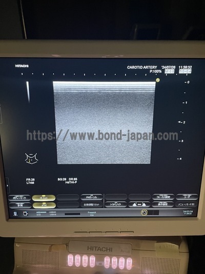 Color Doppler&nbsp;|&nbsp;HITACHI&nbsp;|&nbsp;Hi Vision Avius