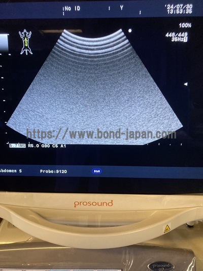 4D Ultrasound&nbsp;|&nbsp;HITACHI&nbsp;|&nbsp;Alpha 7