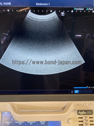 Color Doppler&nbsp;|&nbsp;CANON&nbsp;|&nbsp;Aplio 300