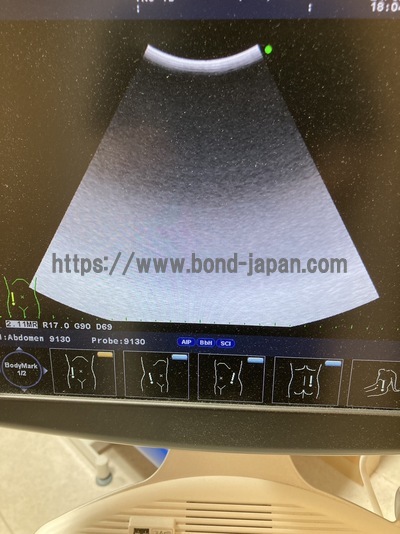 Color Doppler&nbsp;|&nbsp;HITACHI&nbsp;|&nbsp;F37