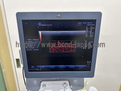 Color Doppler&nbsp;|&nbsp;GE&nbsp;|&nbsp;LOGIQ P6