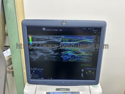 Color Doppler&nbsp;|&nbsp;GE&nbsp;|&nbsp;LOGIQ E9