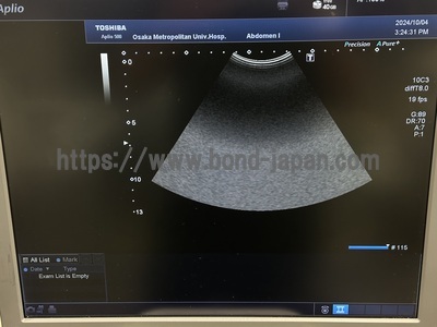 4D Ultrasound&nbsp;|&nbsp;CANON&nbsp;|&nbsp;Aplio 500