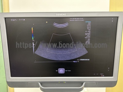 Ultrasound&nbsp;|&nbsp;SIEMENS&nbsp;|&nbsp;Acuson S1000 HELX