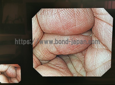 Video Gastroscope&nbsp;|&nbsp;OLYMPUS&nbsp;|&nbsp;GIF-H290Z