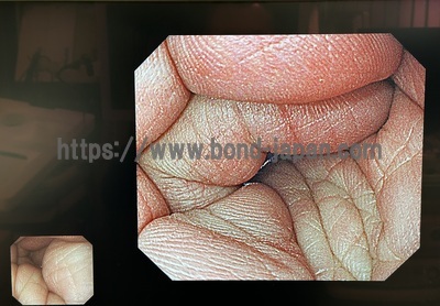 Video Gastroscope&nbsp;|&nbsp;OLYMPUS&nbsp;|&nbsp;GIF-H290Z