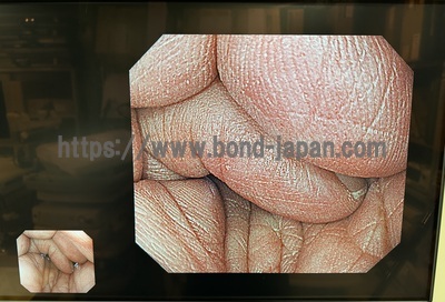 Video Gastroscope&nbsp;|&nbsp;OLYMPUS&nbsp;|&nbsp;GIF-H290Z