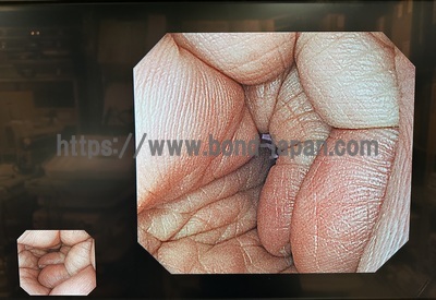 Video Gastroscope&nbsp;|&nbsp;OLYMPUS&nbsp;|&nbsp;GIF-H290Z