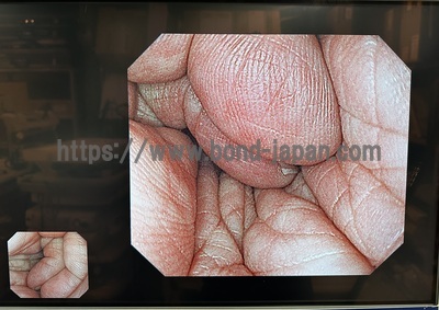 Video Gastroscope&nbsp;|&nbsp;OLYMPUS&nbsp;|&nbsp;GIF-H290Z