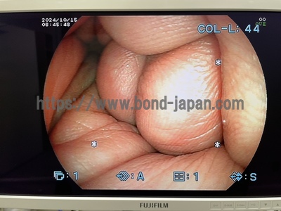 Video Gastroscope&nbsp;|&nbsp;FUJIFILM&nbsp;|&nbsp;EG-530NW