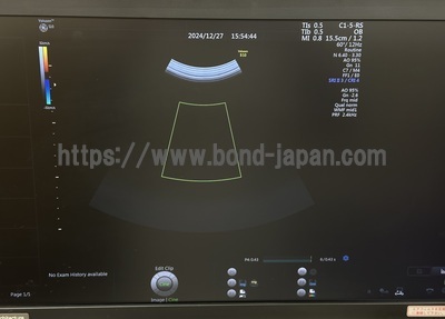 4D Ultrasound&nbsp;|&nbsp;GE&nbsp;|&nbsp;Voluson S10 BT16