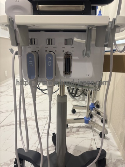 超音波診断装置&nbsp;|&nbsp;コニカミノルタジャパン株式会社&nbsp;|&nbsp;SONIMAGE MX1の写真