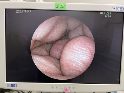 Video Gastroscope&nbsp;|&nbsp;FUJIFILM&nbsp;|&nbsp;EG-530N