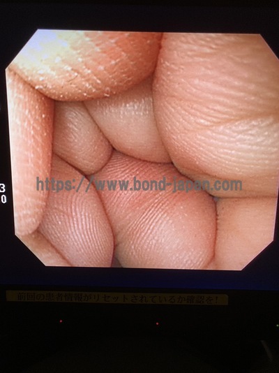 Endoscopy System&nbsp;|&nbsp;OLYMPUS&nbsp;|&nbsp;LUCERA CV-260SL