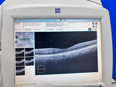 OCT&nbsp;|&nbsp;Carl Zeiss&nbsp;|&nbsp;Cirrus 4000 HD OCT