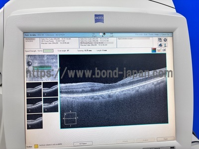 OCT&nbsp;|&nbsp;Carl Zeiss&nbsp;|&nbsp;Cirrus 4000 HD OCT