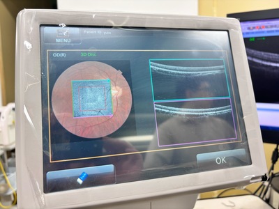 OCT&nbsp;|&nbsp;TOPCON&nbsp;|&nbsp;3D OCT 1 / Maestro 1
