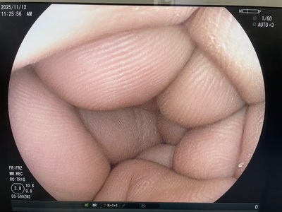 Endosocpy System&nbsp;|&nbsp;FUJIFILM&nbsp;|&nbsp;EPX-3500HD