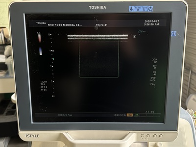 Color Doppler&nbsp;|&nbsp;CANON&nbsp;|&nbsp;SSA-660A Xario