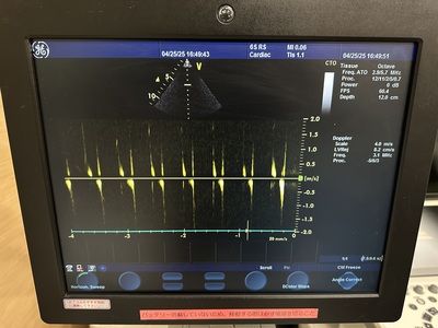 Color Doppler&nbsp;|&nbsp;GE&nbsp;|&nbsp;Vivid S6