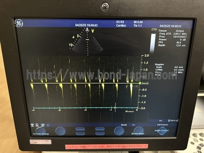 Color Doppler&nbsp;|&nbsp;GE&nbsp;|&nbsp;Vivid S6