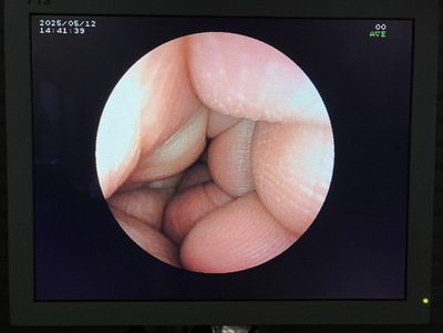 Video Gastroscope&nbsp;|&nbsp;FUJIFILM&nbsp;|&nbsp;EG-3000N