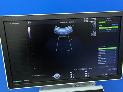 4D Ultrasound&nbsp;|&nbsp;GE&nbsp;|&nbsp;Voluson E8 BT15