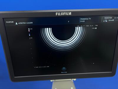 超音波診断装置&nbsp;|&nbsp;富士フィルムヘルスケア株式会社&nbsp;|&nbsp;ARIETTA 50の写真
