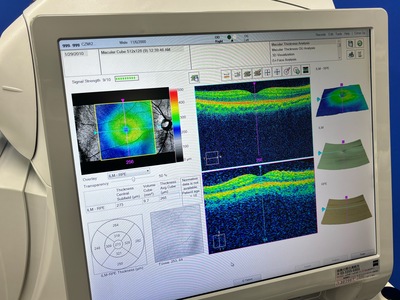 OCT&nbsp;|&nbsp;Carl Zeiss&nbsp;|&nbsp;Cirrus 500 HD-OCT Plus