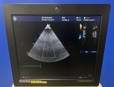 Ultrasound&nbsp;|&nbsp;GE&nbsp;|&nbsp;Vivid E9
