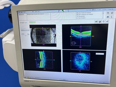 OCT&nbsp;|&nbsp;Carl Zeiss&nbsp;|&nbsp;Cirrus 500 HD-OCT Plus
