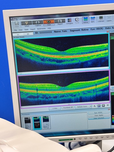 OCT with Non-mydriatic retinal camera&nbsp;|&nbsp;TOPCON&nbsp;|&nbsp;3D OCT 1 / Maestro 1