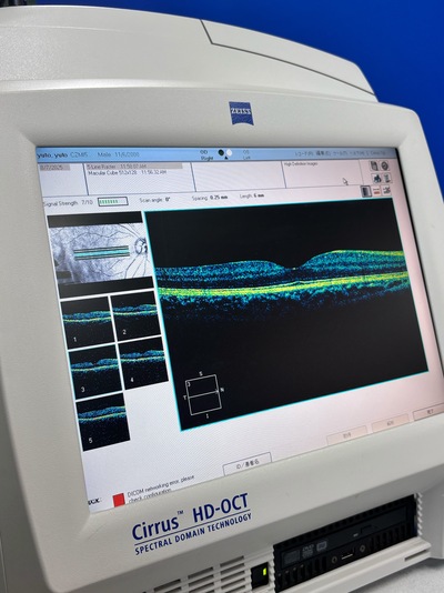 OCT&nbsp;|&nbsp;Carl Zeiss&nbsp;|&nbsp;Cirrus 400 HD-OCT
