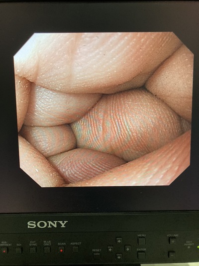 Endoscopy System&nbsp;|&nbsp;OLYMPUS&nbsp;|&nbsp;LUCERA ELITE CV-290